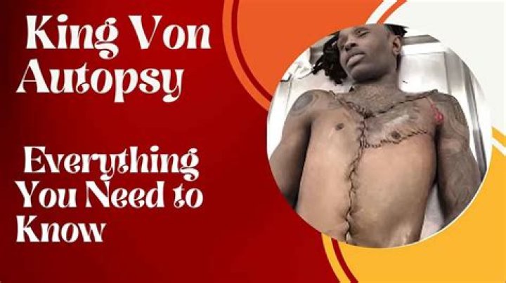 Unraveling The Mystery: King Von Autopsy Photos